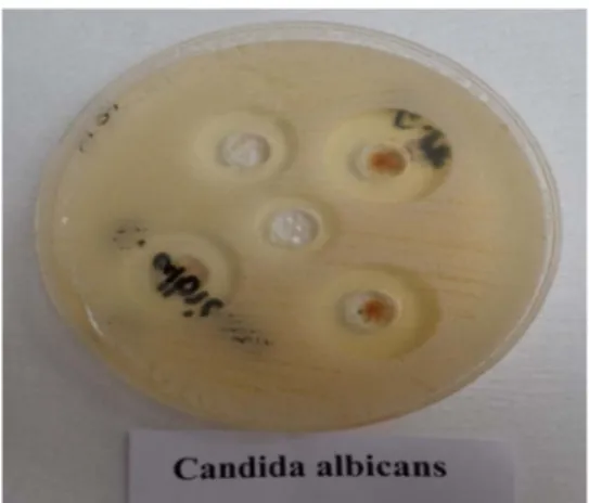 Figure 2. Determining the antifungal sensitivity of C. krusei with paper disk method