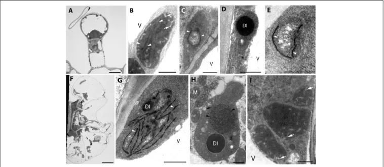 FIGURE 1 | Plastid ultrastructure in capitate (A) and peltate (F) glandular hairs of light-grown rosemary (Rosmarinus officinalis)