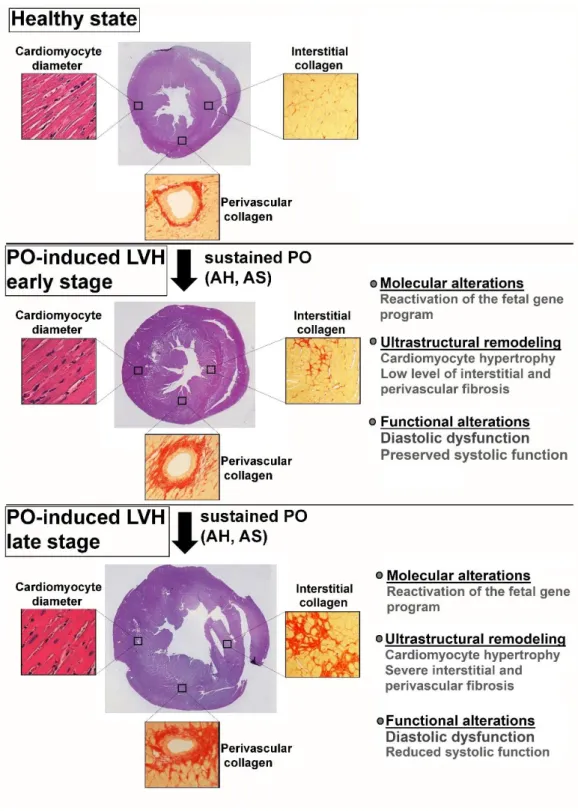 Figure  1.  Summary  of  pressure  overload-induced  pathological  myocardial  remodeling