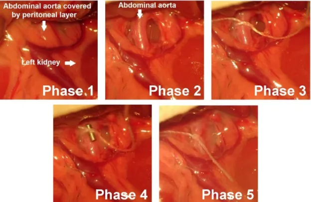Figure 3. Abdominal aortic banding. Photos were taken at different phases during the surgical  procedure of abdominal aortic banding