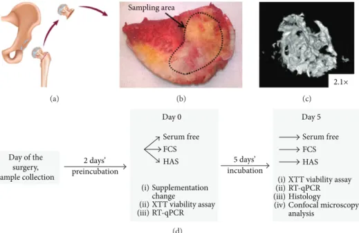 Figure 1: Bone marrow tissue explantation model. During total hip replacement surgery, the femoral head was discarded (a) and replaced with an endoprosthesis