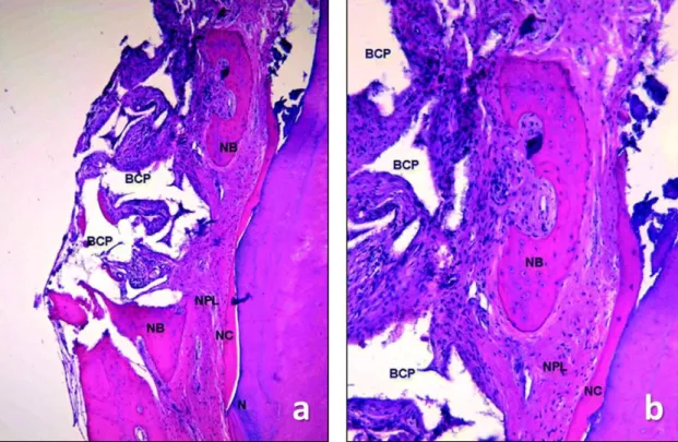 Fig. 5  The  histologic  analysis  demonstrated  (a)  formation  of  new  cementum  (NC),  new  periodontal ligament  (NPL),  and  new  bone  (NB)  along  the  debrided  root  surface  coronally  to  the notch (N)