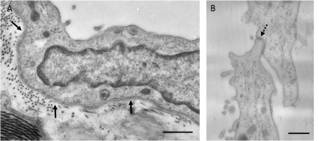 Figure  9.  Electron  micrographs  showing  mesothelial  cells  eleven  days  after  Freund’s  adjuvant treatment