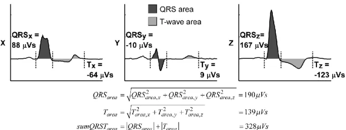 Figure 3. Calculation of the three dimensional QRS and T-wave area using the integral  between the signal and the baseline from beginning to end of the QRS complex or from  the end of the QRS complex to end of the wave, respectively
