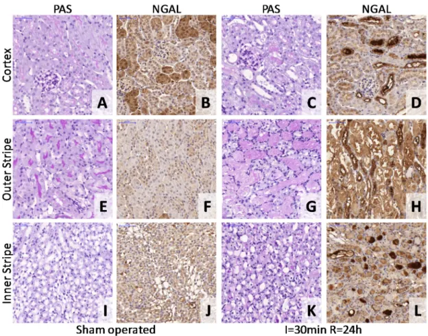 Figure 3. Histopathology and NGAL immunohistochemistry (IHC) after a 30-min renal  ischemia-reperfusion (I/R) injury