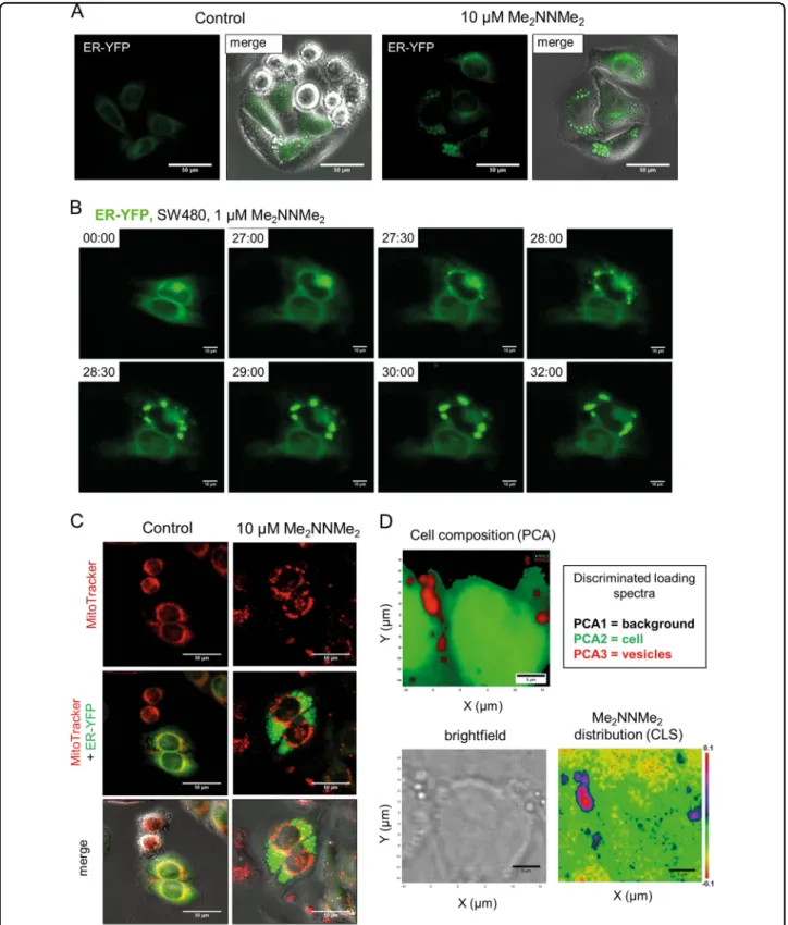 Fig. 2 Me 2 NNMe 2 accumulation in the ER-derived vesicles. a Representative ﬂ uorescence microscopy images and overlaid differential interference contrast images of the ER lumen of ER-YFP-transfected SW480 cells treated with 10 µM Me 2 NNMe 2 for 24 h (sc