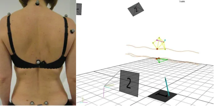 Figure 1. Infrared markers attached to skin and their recorded movement 