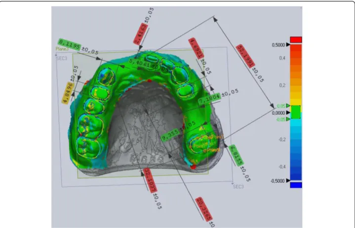 Fig. 9 Virtual digital caliper measurements on prepared teeth: between the mesio-distal and bucco-palatinal points of 14, 21, 24, 27 teeth and 3 arch distances: between the closest points of 24 – 27, furthest points of 24 – 27, and furthest points of 21 – 
