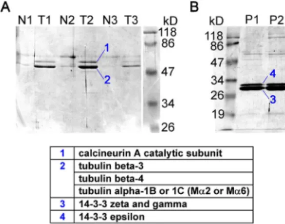 Figure 1. Calcineurin, tubulin and 14-3-3 are the major proteins binding to TRESK-loop-His 8 in affinity chromatography  exper-iments