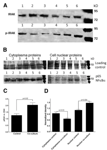 Fig. 2 – IL1- β signaling in co-cultured fibroblasts. A) Detection of IRAK and phosphorylated-IRAK (p-IRAK) protein in cytoplasma extract of control (1 – 3) and co-cultured (4 – 6) fibroblasts