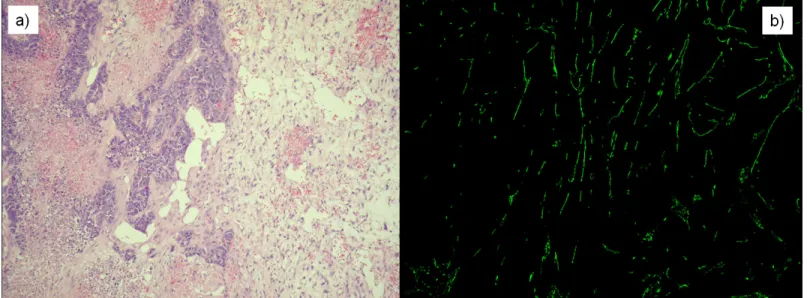 Fig 4. Stained slices in the case of n1 mouse (Phase I, 24th day of the experiment). a) Haematoxylin Eosin (H&amp;E) staining was applied to investigate tumor morphology