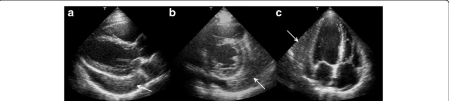 Fig. 3 Cine movie MRI images in the long- (panel a, b) and short-axis planes in diastolic phase (panel c and d)