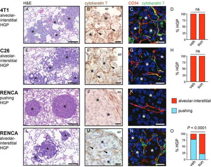 Figure 6. Evidence for vessel co-option in lung metastasis models. Histopathological characterization was performed on lung metastases formed by 4 T1 cells (A–D), C26 cells (E–H) and RENCA cells (I–O) after tail vein injection