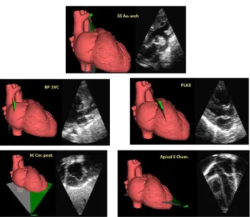 FIGURE 7. M-mode echocardiography using VNETS. Panel A: M-mode of left ventricle for anatomical and functional measurements.