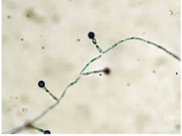 1. ábra Candida albicans chlamydosporaképzés kukoricaagaron, agar- agar-blokk vizsgálata mikroszkóppal