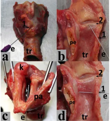 2. ábra A tűelektróda helyzete a bal oldali musculus thyroarytenoideus  (a, b) és a musculus cricoarytenoideus posterior (c, d)  vizsgála-takor