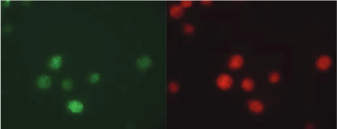 4. ábra. Foszforilált  Ϟ H2AX fókuszok besugárzott Jurkat sejtmagokban, valamint  ugyanazon sejtmagok ﬂuoreszcens mikroszkópos képe (saját felvétel)
