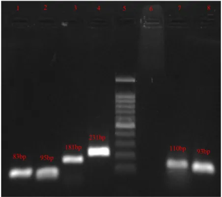 Figure 2. PCR detection of TA genes. Lane1, mazE; lane2, mazF; lane3, samT; lane4, samAT;