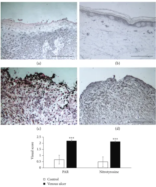 Figure 6: Immunohistochemical detection of nitrotyrosine and poly(ADP-ribose) in ulcer biopsies