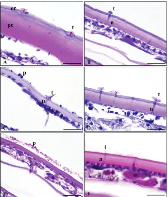 Figure 6. Light microscope micrographs of the studied species’ tergites. Armadillidium vulgare (A),  Cylisticus convexus (B), Orthometopon planum (C), Protracheoniscus politus (D),  Porcellionides pruinosus  (E), Trachelipus rathkii (F)