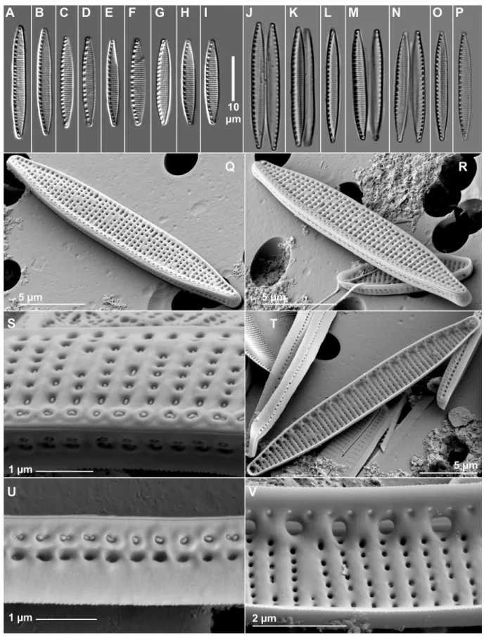 Fig 8. LM (A-P) and SEM (Q-V) micrographs of the new taxon isolated from Apaj.