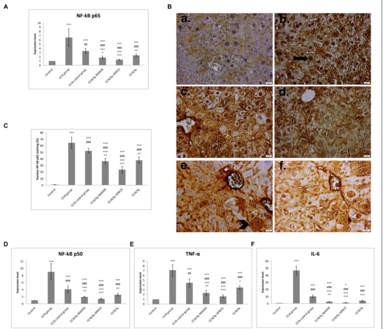 FIGURE 5 | Effects of Sy-HPBCD and Sy-RAMEB complexes on nuclear translocation of NF-kB in hepatocytes and inflammatory cytokines down-regulation in liver fibrosis