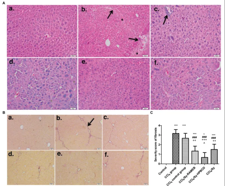 FIGURE 4 | Effect induced by Sy-HPBCD and Sy-RAMEB complexes on the histological changes in liver of CCl 4 -treated mice