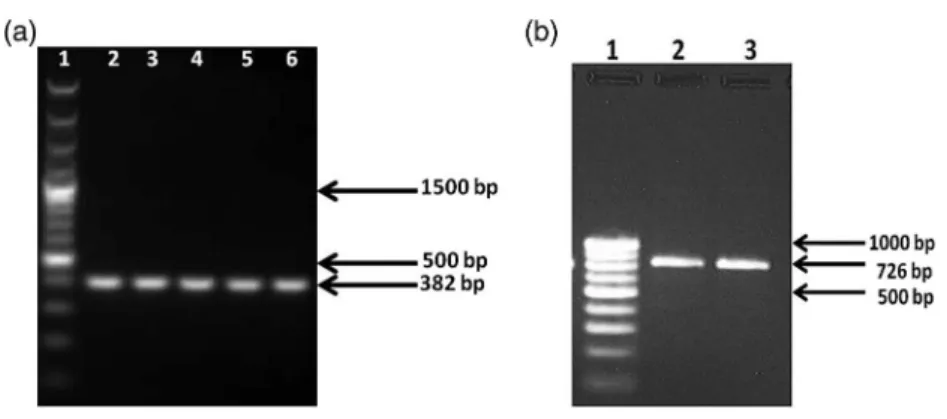 Figure 3. Electrophoretogram of (a) bla VIM gene and (b) bla GIM amplicons run along with 100 bp DNA ladder (Lane 1)
