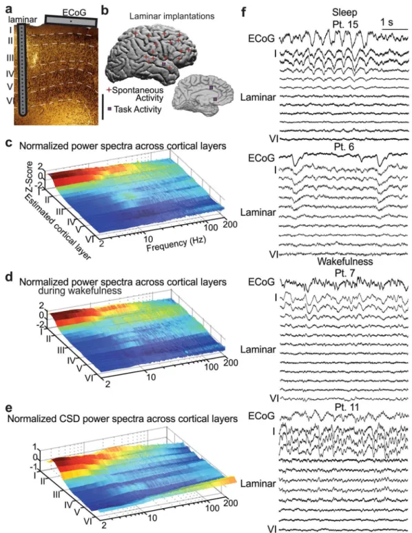Figure 1.  Slow rhythms are generated in superficial cortical layers. (a) A schematic of an implanted laminar  array and surface ECoG contact in a single patient, overlying a histological section taken from an implantation  site