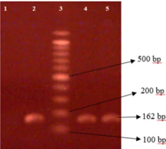 Figure 1. 1% agarose gel electrophoresis analysis of PCR ampli ﬁ cation products of mecA gene of 162 bp extracted from S
