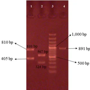 Figure 6. Restriction analysis of spa gene with Bsp1431 restriction enzyme. Column 2 is DNA molecular size marker (100 bp ladder)