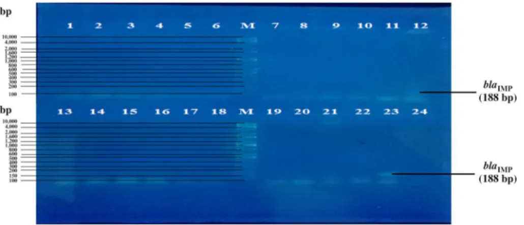 Figure 3. PCR ampli ﬁ cation of the bla NDM-1 gene (983 bp) in carbapenem-resistant Klebsiella pneumoniae ssp