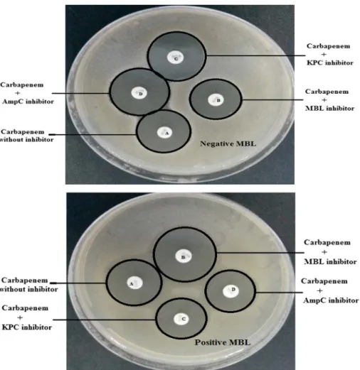 Figure 1. Phenotypic detection of metallo- β -lactamase production by MASTDISCS D70C (positive and negative MBL)