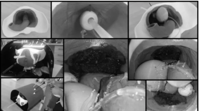 Fig. 6 The new, second prototype of the pelvic phantom with extra features of higher fidelity of Connective Tissue and bleeding effect when cutting the Plexus Santorini