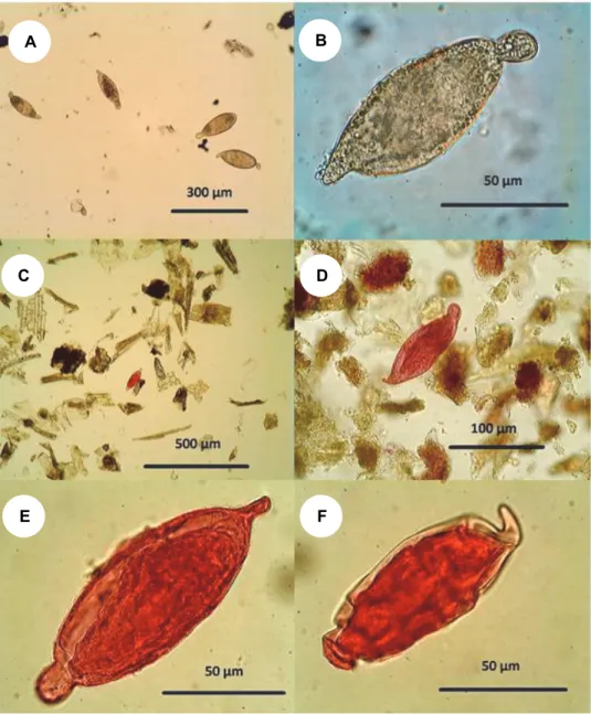 Fig. 3. The appearance of Schistosoma turkestanicum eggs during various procedures.  