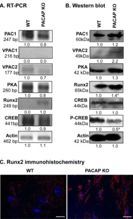 Figure 4. PACAP signalisation in bones. (A) mRNA and (B) protein expression of pituitary adenylate  cyclase-activating  polypeptide  type  I  receptor  (PAC1),  vasoactive  intestinal  polypeptide  receptor  (VPAC)1,  VPAC2,protein  kinase  A  (PKA),  cycl