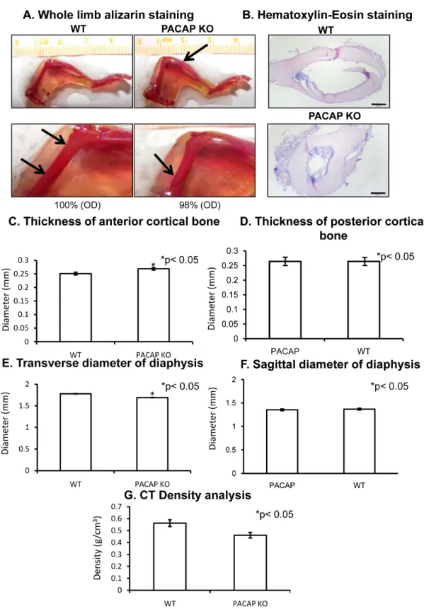 Figure 1. Morphological analysis of hind limbs of wild type (WT) and pituitary adenylate cyclase  activating polypeptide (PACAP) knockout (KO) mice
