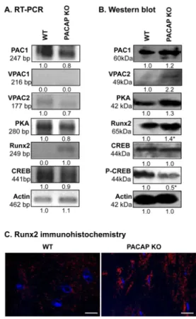 Figure 4. PACAP signalisation in bones. (A) mRNA and (B) protein expression of pituitary adenylate  cyclase-activating polypeptide type I receptor (PAC1), vasoactive intestinal polypeptide receptor  (VPAC)1, VPAC2,protein kinase A (PKA), cyclic adenosine m
