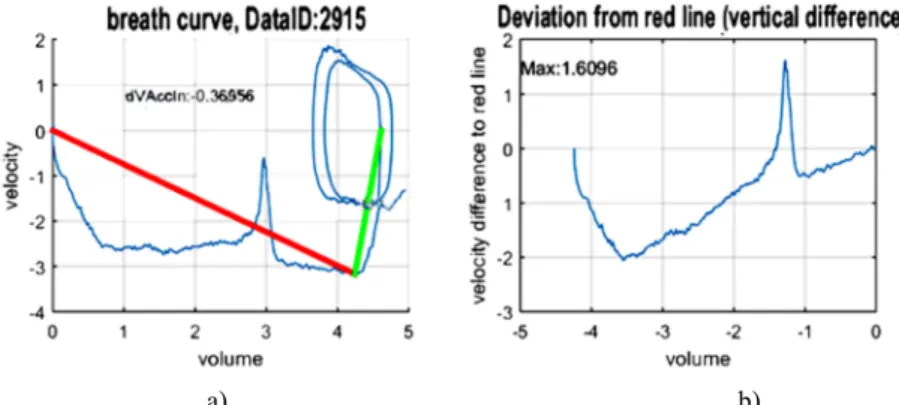 Fig. 7. Characteristics of cluster # 6, a) Notice that the velocity almost get to zero after inhaling 3  liter/second; b) the curve has one local minimum at -2 and one local maximum at 1.6 