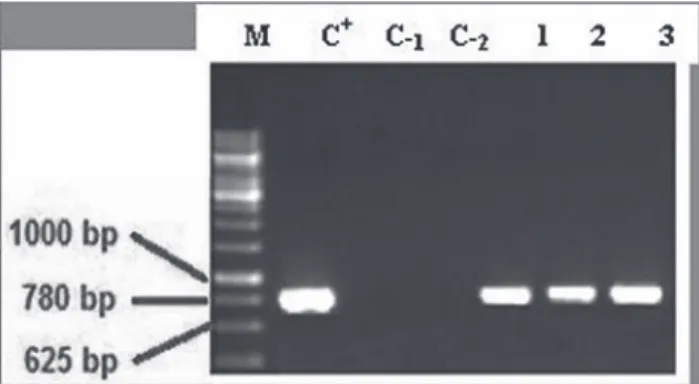 Fig. 1. Polymerase Chain Reaction analysis to determine the presence of rol–B gene in transgenic roots  H