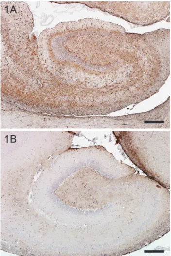 Fig. 1. Immunohistochemical staining demonstrating strong gliosis in hippocampal sclerosis (A),  compared to a control hippocampus (B)