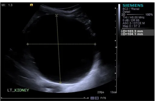 Fig. 4. Surveillance USS showed that the cyst had increased in size to 10.3  10.4  8.5 cm.