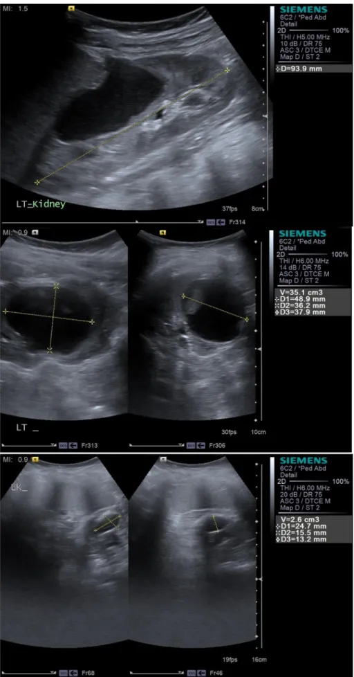 Fig. 7. USS at 3 (1/5/15 e top), 6 (4/8/15 - middle) and 24 months (bottom) post op.