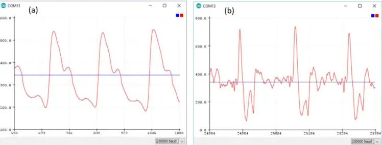 Figure 9. Photoplethysmograph waveform (a) and stethoscope signal (b) measured on the neck displayed on the serial plotter of the Arduino IDE