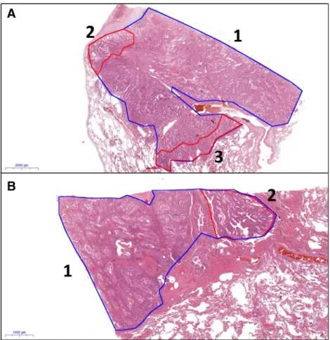 Fig. 1 Examples of annotations of digitalized slides (A: HE, 0.5×;