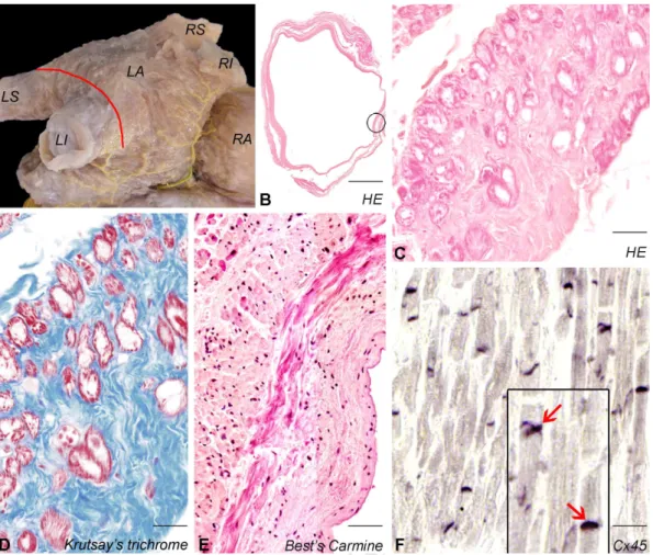 Figure 1. Histology of the PV myocardium. Myocardial extensions into the wall of PVs (LS, LI, 349 