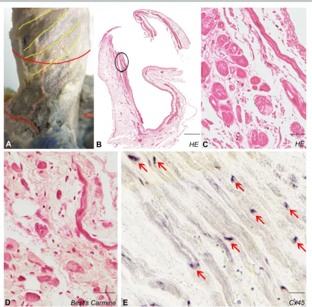 Figure 2. Histology of the SVC myocardium. Cardiomyocyte bundles with spiral course (yellow 361 