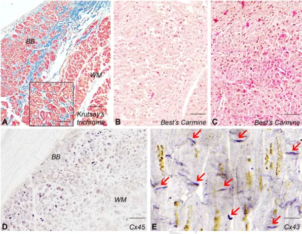 Figure 4. Histology of the left ventricular myocardium. Trichrome staining of the working 384 