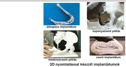 10. ábra Orvostechnikai eszközök 3D nyomtatással 