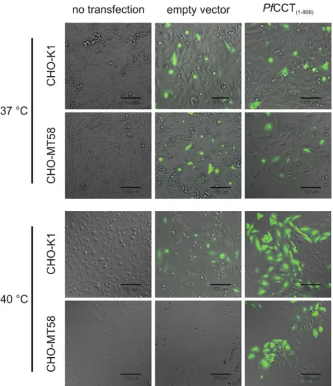 Figure 1.  Overexpression of PfCCT (1–896)  in CHO cells. Brightfield or DIC and fluorescence microscopic images  (40 ×  magnification) were recorded for non-transfected control (left), empty vectot control (middle) and PfCCT/